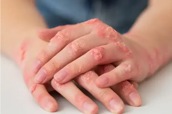 Thumbnail description