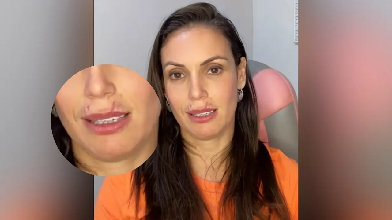 Amália Paci sofre ferimento na boca durante resgate de cão (Reprodução)