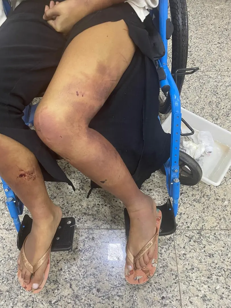 MP denuncia homem acusado de torturar namorada em Rio Preto
